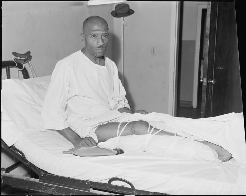 Charlie Williams who works for the Pocahontas Corporation, at the Amonate Mine, received a fractured leg in a mine... -…